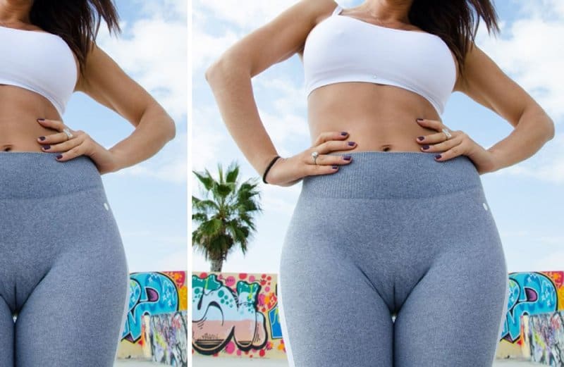 How To Prevent Camel Toe In Leggings?